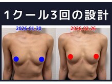 セブンシーズ 上野店(Seven Seas)/バストアップ/豊胸/東京都/上野