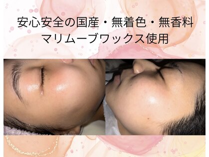 スモモ(Su100)の写真