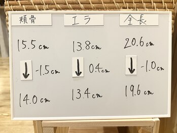 美整庵 谷山店(BISEIAN)/フェイスライン－1.5cmの写真