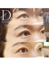 フェリチェート(feliceto)/ダブルアイリフトでスッキリ目元