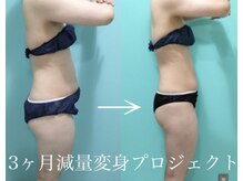 アリスビューティプラス(Alice Beauty+)の雰囲気（ダイエット減量コース実施中☆３ヶ月でウエスト－10cm達成☆）