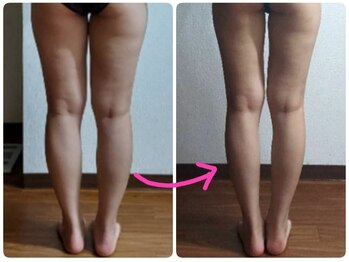 痩身と癒しのリンパサロン コッコ(Cocco)/美脚へ( *´艸｀)