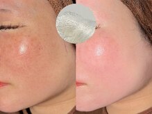 ルーナジェーナ(Luna llena)/池袋/目白/雑司ヶ谷/エステ