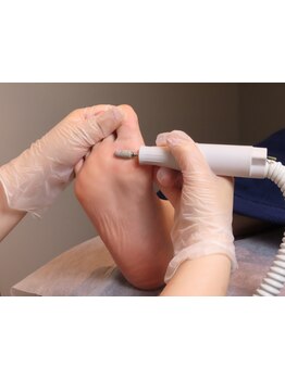 角質ケアができるサロン