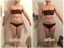 トリート(TREAT)/ビフォー&アフター　H様(前）