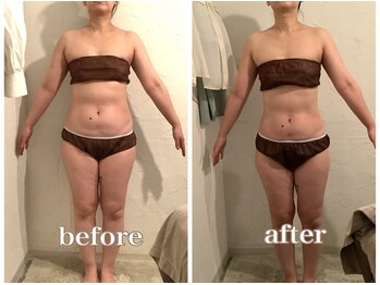 トリート(TREAT)/ビフォー&アフター H様(前)