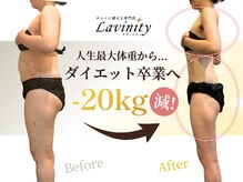 ラヴィニティ 自由が丘店(Lavinity)