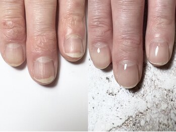 アンバー ネイル バイ チップタップ(amber nail by tip top)の写真/自爪育成で健康的で美しい自信が持てる指先になりませんか？お悩みを一緒に改善し自分史上最高の美爪へ♪