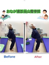 おなが浦添当山整骨院/慢性腰痛でも可動域拡大