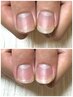 【自爪育成/深爪・二枚爪】健康的で美しいお爪へ5回コースホームケアセット付