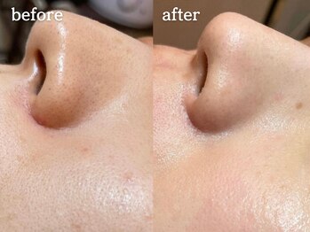 メルシア(merucia)/