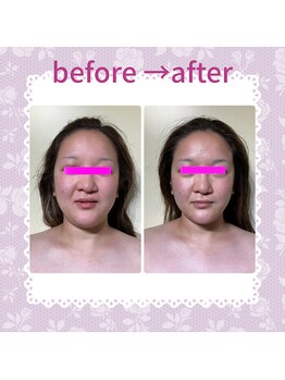 ビサイド(美side)/【美sideフェイシャル】