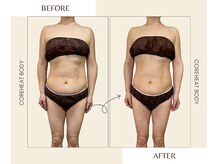 セレナ(Serena)/コアヒートボディBefore/After