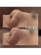 ナチュリー(Natully)/お客様ビフォーアフター