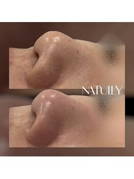 ナチュリー(Natully)/お客様ビフォーアフター