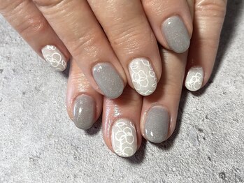 イデアル(Ideal)/【パラジェル】定額Sコース