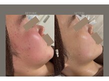 ジーニー(JINNY)の雰囲気（年齢に関わらず、根本からの肌質改善効果はフォトギャラリーへ）