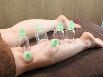 ことり整体サロン/カッピング(下半身)