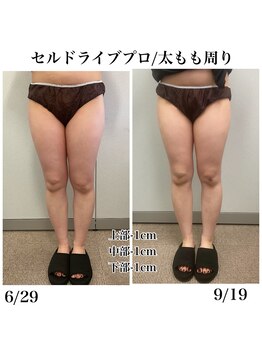 ヴィーナス(Venus)/セルフボディエステ