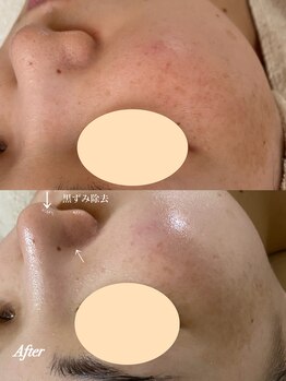 ドゥクス 難波店(Dux)/幹細胞タラソ