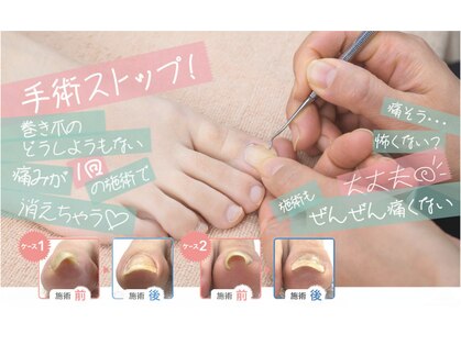 富山巻き爪整体院の写真