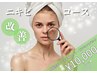 【New】特別価格！ホームケア付◎肌質改善！ニキビ・跡改善特化コース　