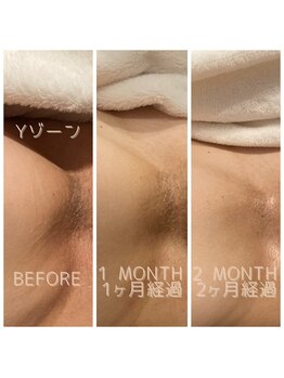 リュクス  Luxe＋tkm 南船場/ローマピンク