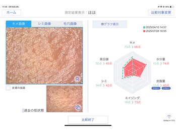 ミンミ(MiNMi)/お肌診断