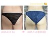 ★最速ボディ痩身【韓国レモンボトルorレッドショット】選べる¥33000→¥11000
