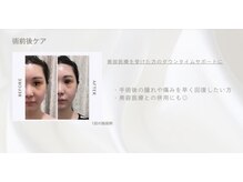 ココーラ(COCCOLA)の雰囲気（美容施術後のアフターケアお任せください！）