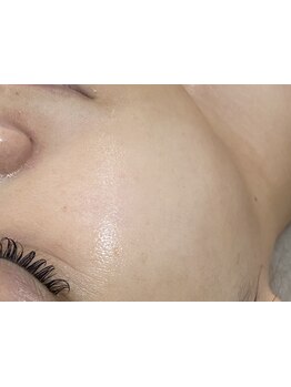 お肌をきれいにしたい