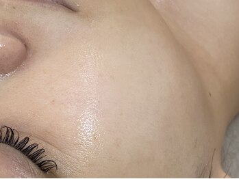 ラプア(Lapua)の写真/韓国で話題の「ラピエラピーリング」で美しいツヤ肌に♪乾燥が気になるこれからの季節にぴったり◎