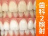 【会員／回数券】20分×2回歯科提携セルフホワイトニング