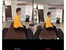 ストレチックス 近江八幡店/姿勢改善ビフォーアフター1回