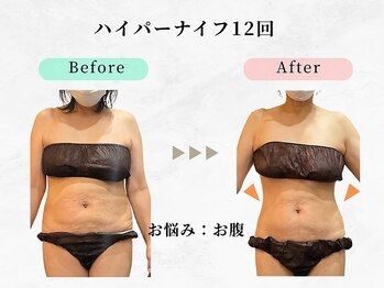 美容整体ウェリナ 名駅院/小顔矯正/骨盤矯正/痩身整体