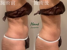 ハネ 自由が丘(Hane)/[自由が丘/インディバ/むくみ]