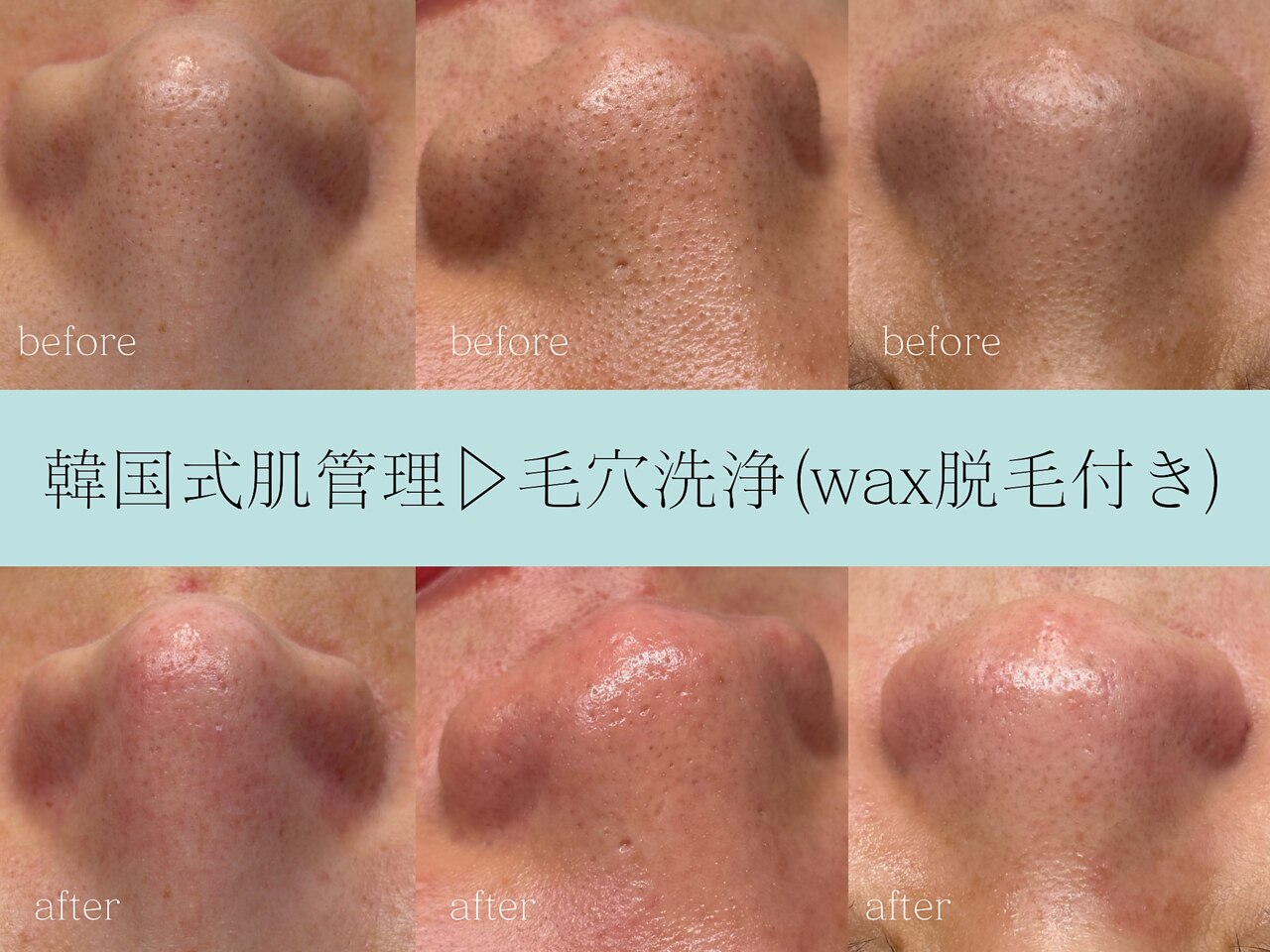 レア(Lea)｜ホットペッパービューティー