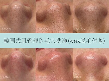 レア(Lea)の写真