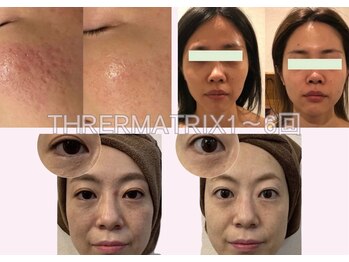 リジュベネーションサロン アリス(Alice)/サーマトリックスB&A