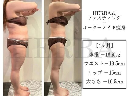 ヘルバ(HERBA)の写真