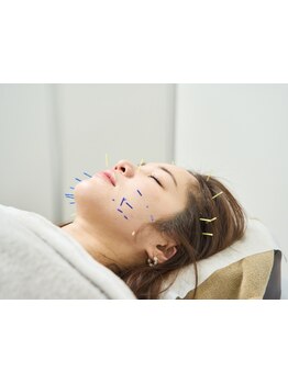 鍼灸施術を受けたい