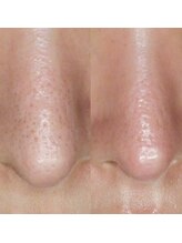 シャイネル(SHYNELL)/