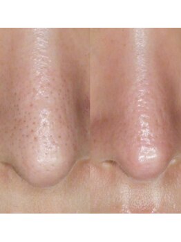 シャイネル(SHYNELL)/