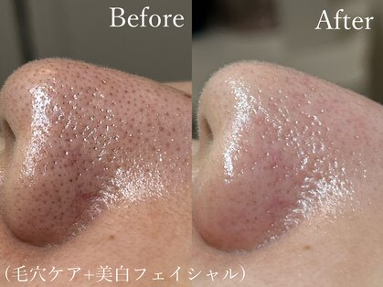 フレーズ(fraise)の写真