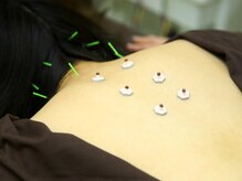 エムハナ鍼灸院(M.hana鍼灸院)の雰囲気（【全身鍼灸】優しい刺激からしっかりめの刺激まで調整出来ます）