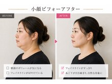 ベアフット(BARE FOOT)/骨までエステ