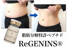 ハッピーエンジェル(Happy Angel)の雰囲気（次世代【レジェニンS】脂肪分解液＋引き締め美肌）