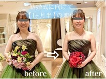 フィス エステティックサロン