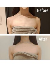 リサスミー(Lithas Me)/肩の盛り上がりだって…