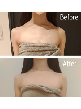 リサスミー(Lithas Me)/肩の盛り上がりだって…